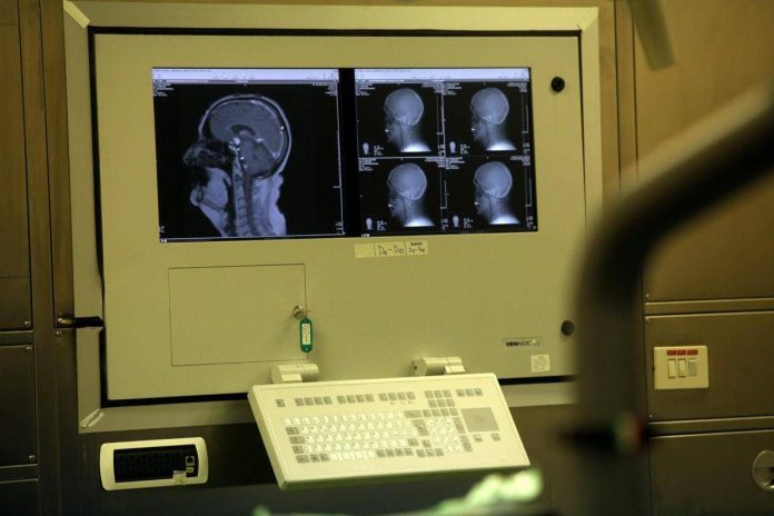 intervento_chirurgico_all_istituto_neurologico_besta