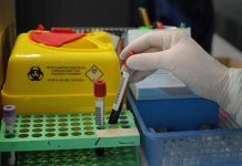 Tumori, nuovo test del sangue ‘low cost’ promette di scoprire diversi tipi di cancro