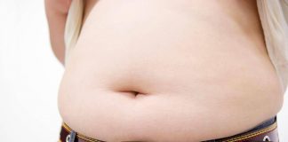 Obesità, allarme ictus anche nei giovani: peso in eccesso moltiplica il rischio