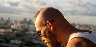 Alopecia androgenetica maschile: riconoscerla fa la differenza