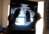 Sirm: “Ai strumento anti liste d’attesa, 50% esami imaging per over70 non necessario”