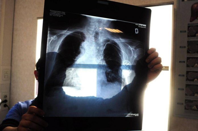 centro_cardiologico_monzino_tac_cardiovascolare_di_ultima_generazione
