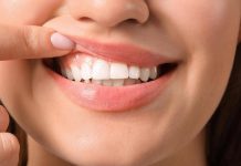 Denti a rischio tra i giovani, Sidp: “Il 36% della Gen Z ha gengive che sanguinano”