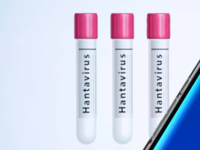 hantavirus8_ipa