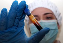 Hantavirus, negativo il turista inglese in quarantena a Milano. Test per una donna ricoverata a Messina