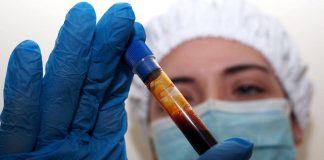 Hantavirus, negativo il turista inglese in quarantena a Milano. Test per una donna ricoverata a Messina