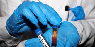 Hantavirus, test negativo per la persone in isolamento in Veneto