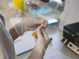 Cancro prostata metastatico ormonosensibile, nuovi dati su darolutamide mostrano benefici in sopravvivenza