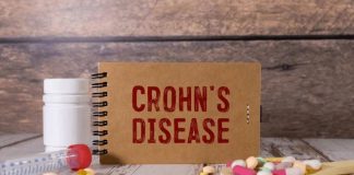 Malattia Crohn con fistole, nuovi dati su terapia monoclonale