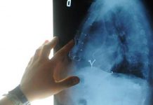 Radiologia interventistica, Ssn e fondazioni per cure più accessibili