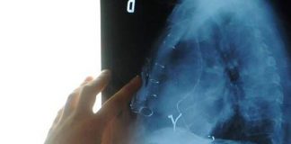 Radiologia interventistica, Ssn e fondazioni per cure più accessibili