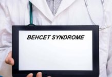 Giornata sindrome Behçet, esperto: “Oggi possiamo prevenire cecità”
