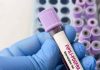Giornata patologie eosinofile, allergologo Caminati: “Diagnosi complessa”