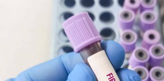 Giornata patologie eosinofile, allergologo Caminati: “Diagnosi complessa”