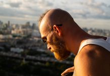 Alopecia androgenetica maschile: riconoscerla fa la differenza