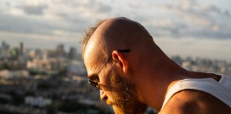 Alopecia androgenetica maschile: riconoscerla fa la differenza