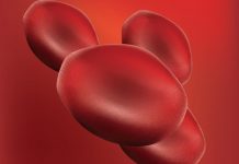 Autoemotrasfusione di ozono anti-aging, cos’è: ma fa bene davvero?