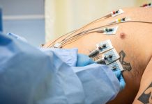 Caldo, disidratazione e sbalzi pressori: ecco le 10 regole per proteggere la salute del cuore