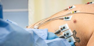 Caldo, disidratazione e sbalzi pressori: ecco le 10 regole per proteggere la salute del cuore