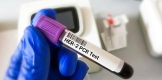 Tumore gastroesofageo Her2+, risultati positivi per tislelizumab con zanidatamab e chemio