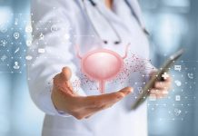 Cancro alla vescica, approvato rimborso per immunoterapia prima e dopo chirurgia