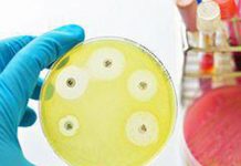 Ai e medicina di precisione per combattere super batteri resistenti, lo studio italiano su quasi 10.000 pazienti