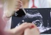 Chirurgia, si rompe l’aorta e viene operata con il bimbo in utero, intervento record a Milano