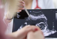 Chirurgia, si rompe l’aorta e viene operata con il bimbo in utero, intervento record a Milano