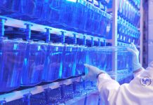 Scoperta una nuova malattia genetica del neurosviluppo