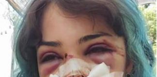 Bari, studentessa picchiata al parco: indagati per lesioni e rapina custode bagni e il compagno