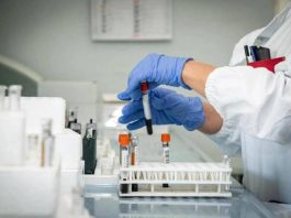 Alzheimer, nuovo test del sangue potrebbe prevedere sintomi imminenti