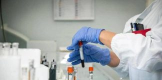 Alzheimer, nuovo test del sangue potrebbe prevedere sintomi imminenti