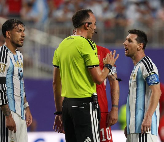 Argentina-Svizzera, rigore non dato e rosso a Embolo: proteste ai Mondiali