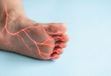 Asl Roma 4, presentato nuovo Pdta per neuropatia diabetica dolorosa