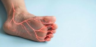 Asl Roma 4, presentato nuovo Pdta per neuropatia diabetica dolorosa