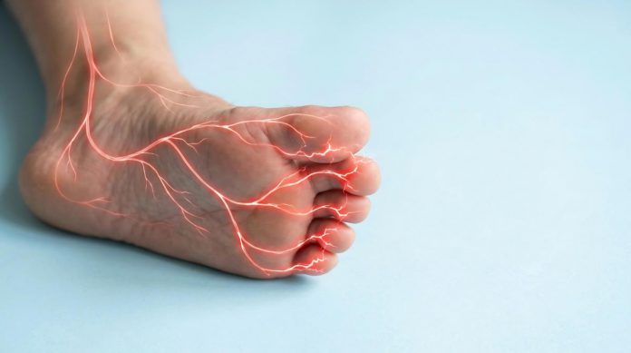 neuropatia_diabetica_adobe