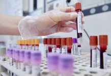 Hiv, dalla Sicilia il modello per estendere terapie long acting