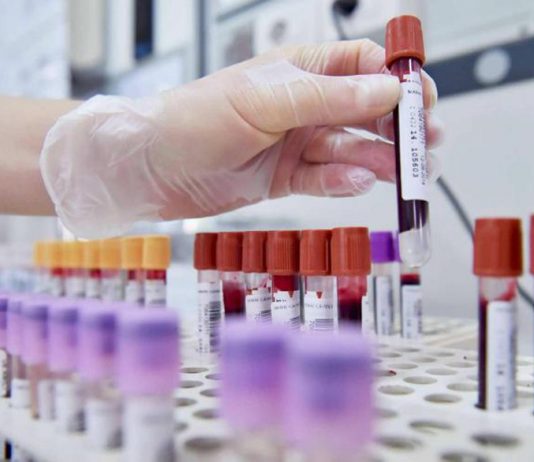 Hiv, dalla Sicilia il modello per estendere terapie long acting