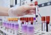 Dal microbiota una speranza contro l’epilessia resistente, lo studio italiano
