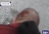 Caso Fakir, Tg1: fotogramma da bodycam poliziotto mostra ferita sulla nuca