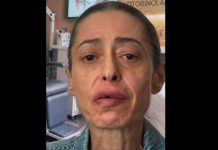Gerardina Trovato annulla il tour: “Devo operarmi d’urgenza”