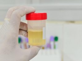 Dai segnali del colore alla postura, sui social è ‘urina mania’ tra scienza e falsi miti