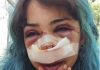 Bari, studentessa picchiata nei bagni denuncia nuovo episodio: “Mi hanno accerchiata”