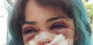 Bari, studentessa picchiata nei bagni denuncia nuovo episodio: “Mi hanno accerchiata”