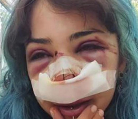 Bari, studentessa picchiata nei bagni denuncia nuovo episodio: “Mi hanno accerchiata”