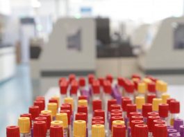 Cos’è il batterio mangiacarne sotto la lente a Messina, minaccia in crescita per il caldo record
