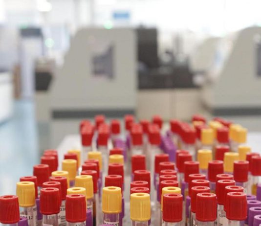 Malaria in aeroporto in Germania, gli esperti: “Campanello d’allarme, ma il rischio resta contenuto”
