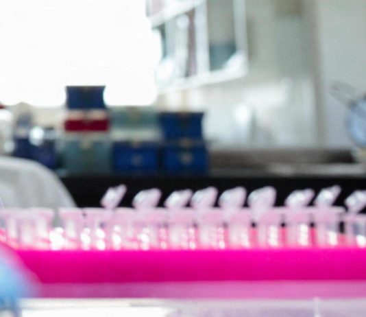 Milano, focolaio di tubercolosi all’Istituto di Medicina legale: 8 casi conclamati e 7 positivi