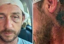 “Io aggredito a sassate in Sardegna da 30 persone perché gay”, la denuncia sui social 