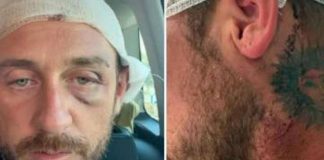 “Io aggredito a sassate in Sardegna da 30 persone perché gay”, la denuncia sui social 